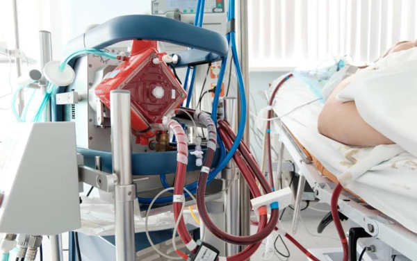 熱點(diǎn) | 填補(bǔ)國產(chǎn)空白，ECMO迎來“中國造”